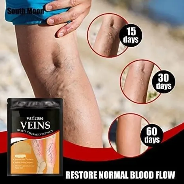 Varicose_Veins_Relief_Patches_30_Pcs_Pack_Of_3_Reduces_Swelling_Relieves_Pain_Improves_Blood_Circulation_Vein_Health_Herbal_Skin_Friendly_Instant_Pain_Relief_Pack_Of_2