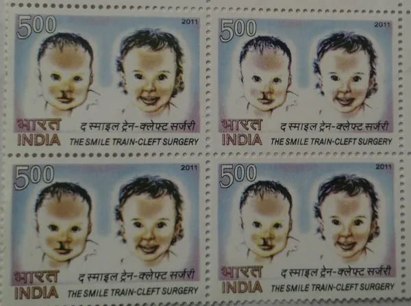 India_-_2011_-_The_Smile_Train_Cleft_Surgery_Thematic_(Block_of_4_stamp)_-_MNH_-_Pack_of_2