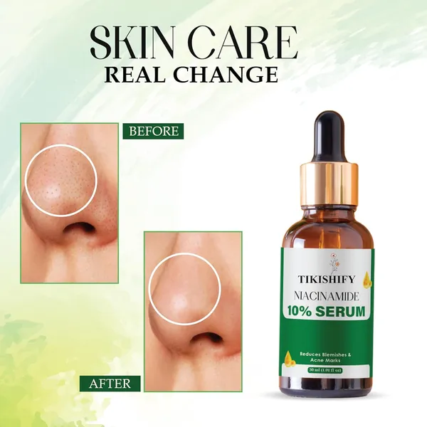 Niacinamide_10_Serum_Reduces_Blemishes_Acne_Marks_30Ml_1_01_Fl_Oz
