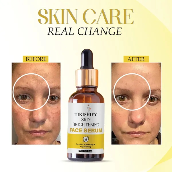 Skin_Brightening_Face_Serum_For_Skin_Whitening_Brightening_30Ml_1_01_Fl_Oz