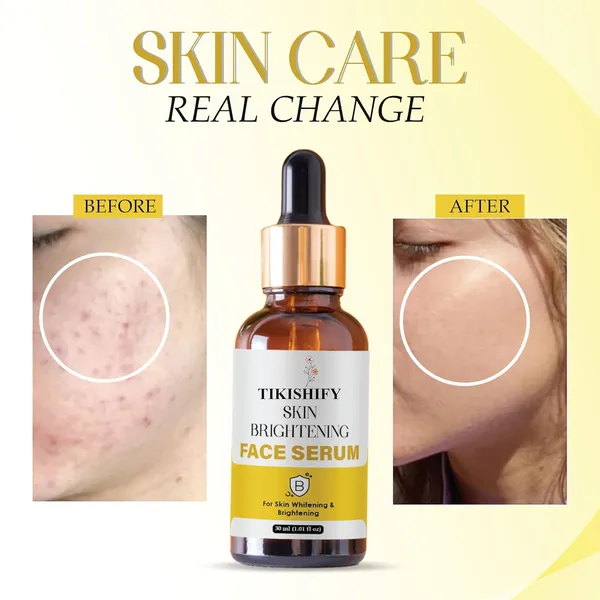 Skin_Brightening_Face_Serum_For_Skin_Whitening_Brightening_30Ml_1_01_Fl_Oz