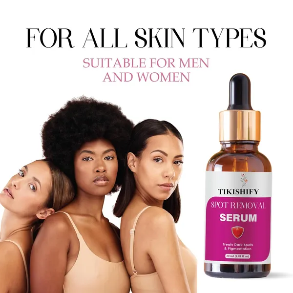 Spot_Removal_Serum_Treats_Dark_Spots_Pigmentation_30Ml_1_01_Fl_Oz