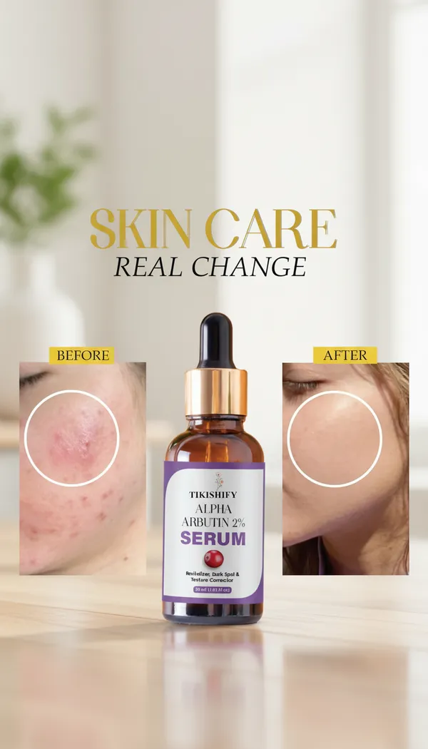 Alpha_Arbutin_2_Serum_Revitalizer_Dark_Spot_Texture_Corrector_30Ml