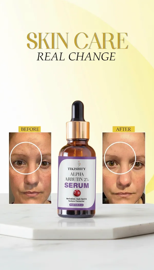 Alpha_Arbutin_2_Serum_Revitalizer_Dark_Spot_Texture_Corrector_30Ml
