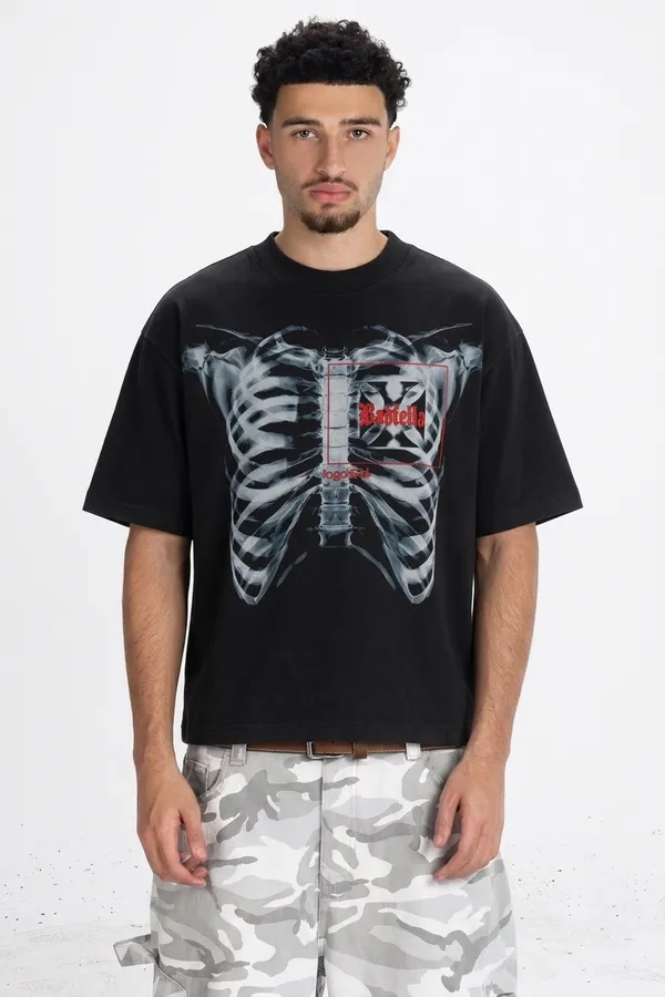X-Ray_tee