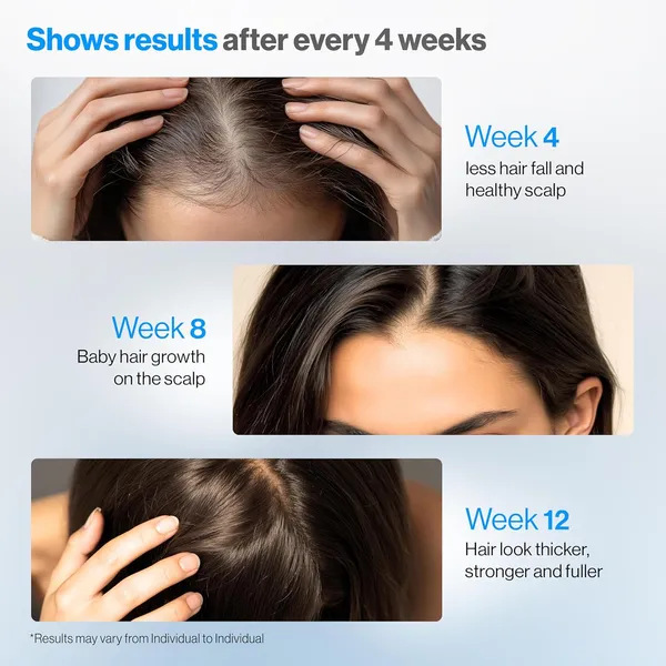 Valmia_Advance_Hair_Growth_Serum_with_Redensyl_,_Products_for_Women_&_Men_,_Aminexil,_Caffeine,_EXO_FDS_Follixield_,_Serum_for_Hair_Thinning_&_Shedding_,_Brown_Enhancer_,_Control_Hair_Fall_,_Fuller_Looking_Hair_,_30ml