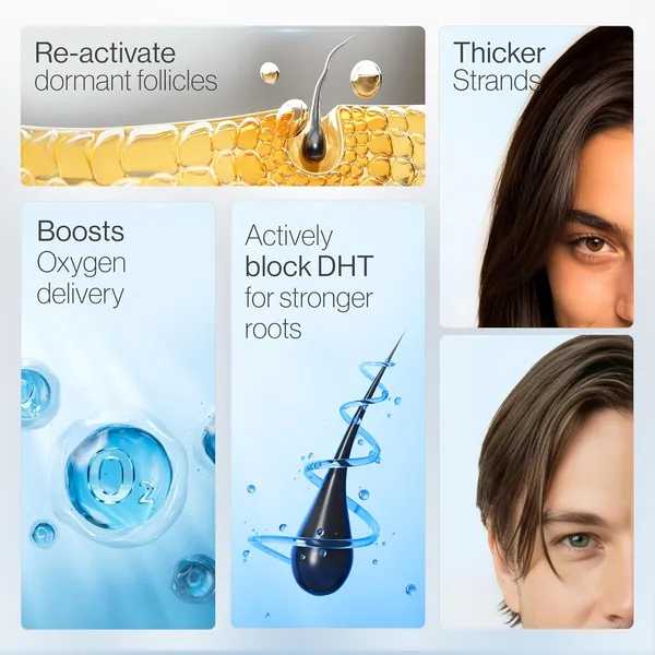 Valmia_Advance_Hair_Growth_Serum_with_Redensyl_,_Products_for_Women_&_Men_,_Aminexil,_Caffeine,_EXO_FDS_Follixield_,_Serum_for_Hair_Thinning_&_Shedding_,_Brown_Enhancer_,_Control_Hair_Fall_,_Fuller_Looking_Hair_,_30ml