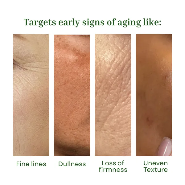 Phyto_Face_B_Tox_Serum_Br_Br_With_Peptides_Niacinamide_Hyaluronic_Acid_Youth_Restore_Complex_Anti_Aging_Wrinkle_Reducing_Tightens_Smooths_Restores_Bounce_For_All_Skin_Types_20g_20g_0_71_Oz