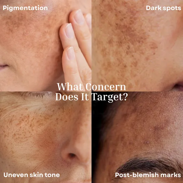Dark_Spot_Fade_Face_Cream_Br_Br_Tone_Perfecting_Night_Cream_Enhances_Skin_Clarity_Helps_Visibly_Fade_Dark_Spots_Pigmentation_30g_30g_1_06oz