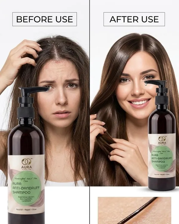 Aura_Anti-Dandruff_Shampoo_-_Ayurvedic_Hair_&_Scalp_Care