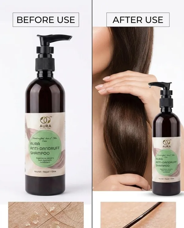 Aura_Anti-Dandruff_Shampoo_-_Ayurvedic_Hair_&_Scalp_Care
