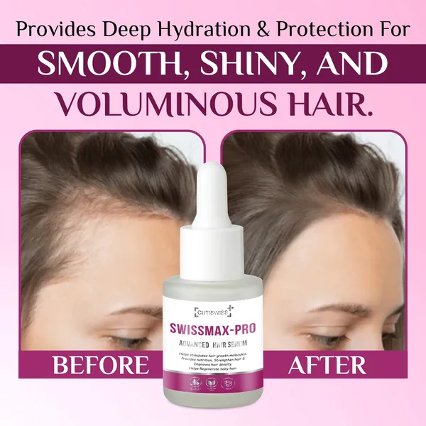 Swissmax-Pro_Advanced_Hair_Serum_|_Enriched_With_Niacinamide,_Biotin,_Chamomile,_Glycerin,_Redensyl,_Larix_Europaea_Wood_Extract,_Camellia_Sinensis_Leaf_Extract,_Apigenin,_Oleanolic_Acid,_Pisum_Sativum_Sprout_Extract_&_Capila_Longa_|_Calm,_Irritation_And_Inflammation_Free_Scalp_|_Targets_Hair_Thinning_&_Hair_Loss_|_30Ml