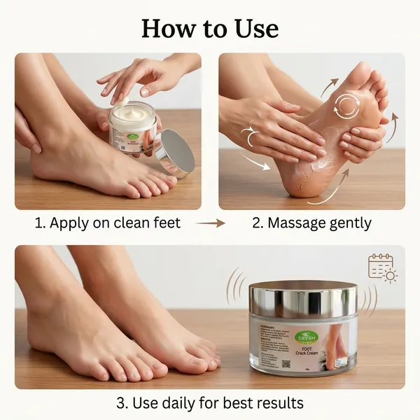 Srysh_Herbals_Foot_Crack_Cream