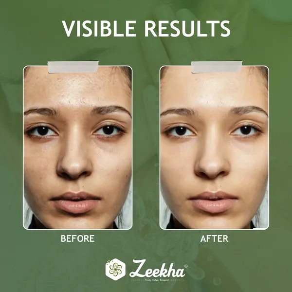 ZEEKHA_Instant_Glow_Face_Wash,_Skin_Lightening_&_Tan_Removal_Face_wash,Oil_Controal_&_Remove_Pigmentation_,_Tan_Removal_Face_Wash,_All_Skin_Types_Face_Wash_100ml_(Pack_of_2)