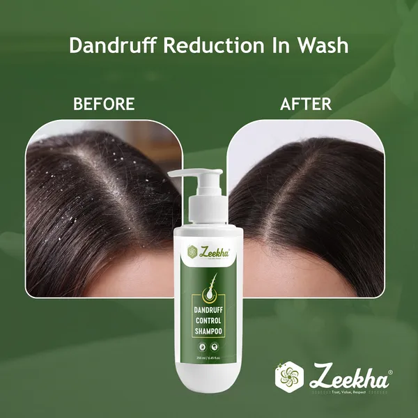 ZEEKHA_Anti_Dandruff_Shampoo_|_Reduces_Up_to_100%_Dandruff_and_Strengthens_Hair_result_in_6-8_wash__|_Salicylic_&_Biotin_|_Shampoo_For_All_Hair_types_|_For_Women_And_Men_|_250ml_-_Pack_Of_2