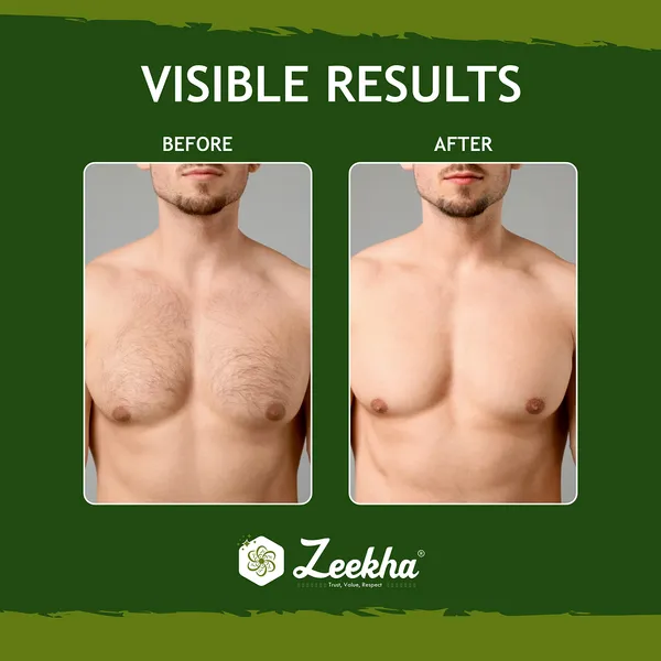 ZEEKHA_100%_Original_Hair_Removal_Cream_for_Men_&_Women,_Painless__Hair_Removal_Cream_for_Chest,_Back,_Under_Arms_&_Intimate_Area_Easy_To_Use_Quick_Result_7-9_Minit’s_Hair_Remover__(100ml)