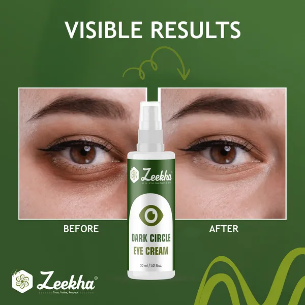 ZEEKHA_Dark_Circles,_Under_Eye_Cream_for_Dark_Circles,_with_Cucumber_&_Peptides_-_30ml"