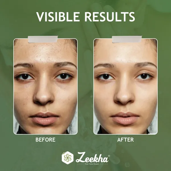 Zeekha_3-Step_Glow_&_Repair_Skincare_Kit_–_Brightening_Face_Wash,_Dark_Circle_Eye_Cream_&_Nourishing_Night_Cream