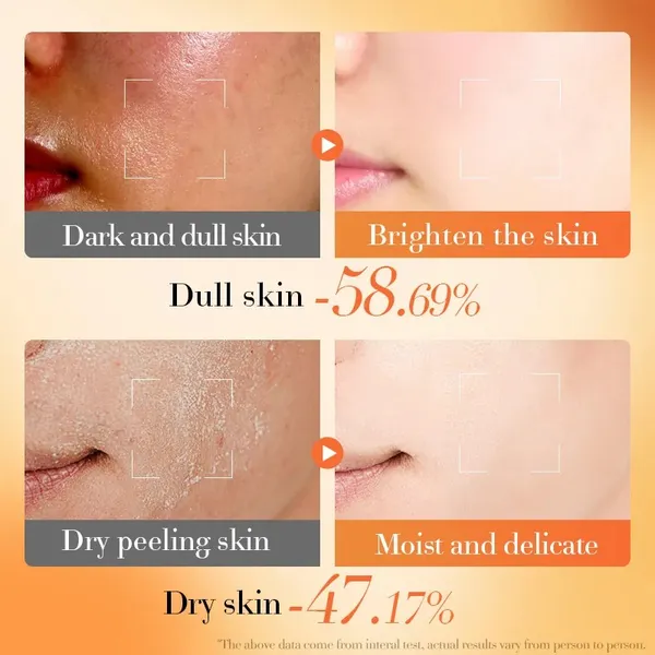 Bioaqua_Vs_+_B5_Moisturizing_Cream_|_Deep_Hydration_&_Skin_Repair_|_Vitamin_B5_Enriched_Face_Cream_For_Soft,_Smooth_&_Glowing_Skin_|_Suitable_For_All_Skin_Types_|_50G