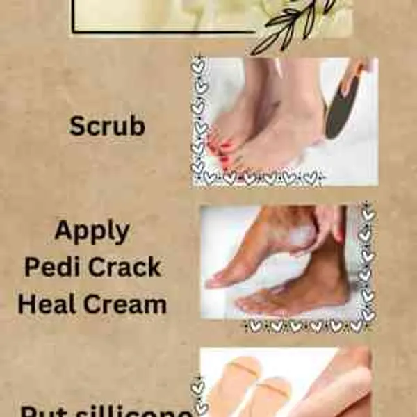 Heal_Cream_Pedi_Crack
