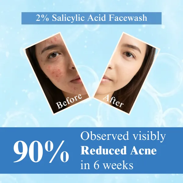 Blomera_Care_Salicylic_Acid_Face_Wash_-_2%_Salicylic_Acid_for_Acne_Control_&_Deep_Cleansing_(100ml)