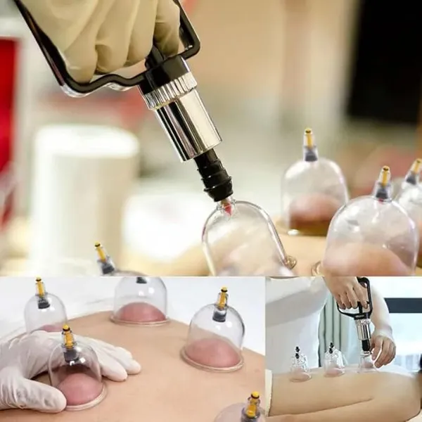 Acupressure_Vacuum_Cupping_Therapy_Set_Chinese_Traditional_Healthy_Body_Vacuum_Acupuncture_Cupping_For_Cellulite_Cupping_Massage_Set_Of_6