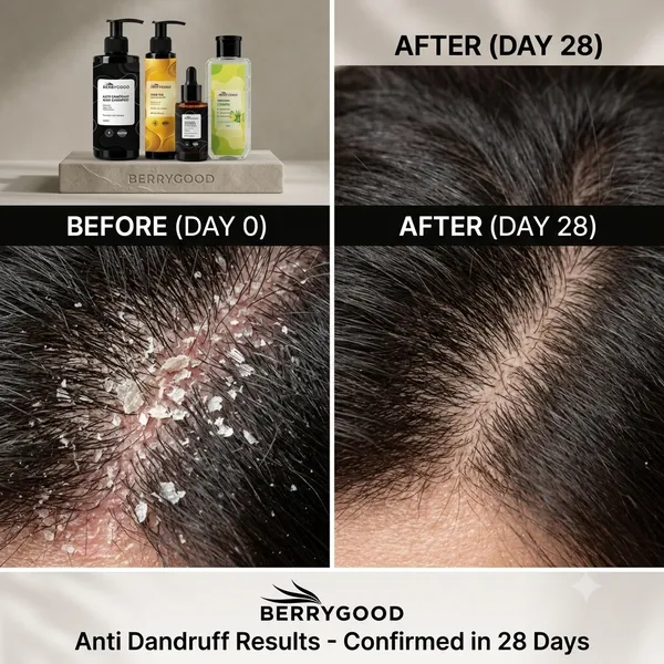 HAIR_TREATMENT_COMBO_(PACK_OF_4)