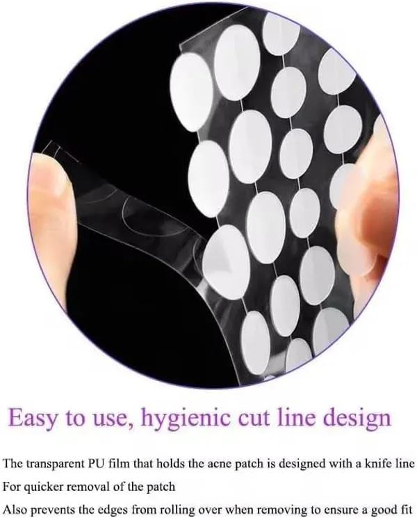 Hydrocolloid_Acne_Patches