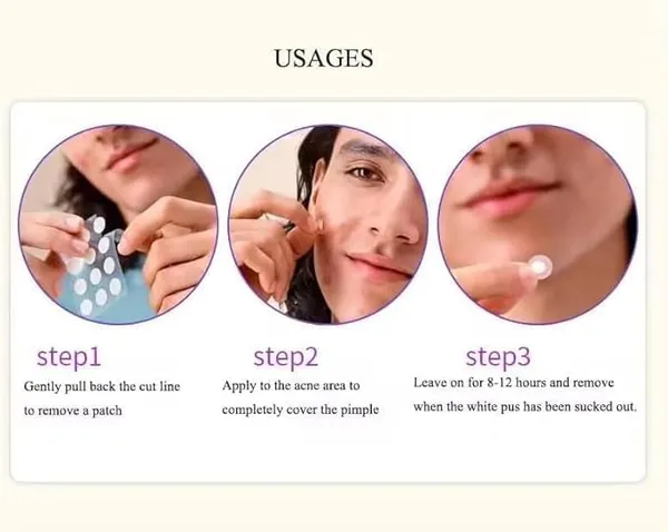 Hydrocolloid_Acne_Patches