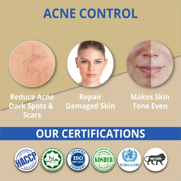 Acne_Control_Face_Treatment_Kit_-_Reduces_Dark_Spots,_Repairs_Damaged_Skin_&_Evens_Skin_Tone_Pack_Of_2