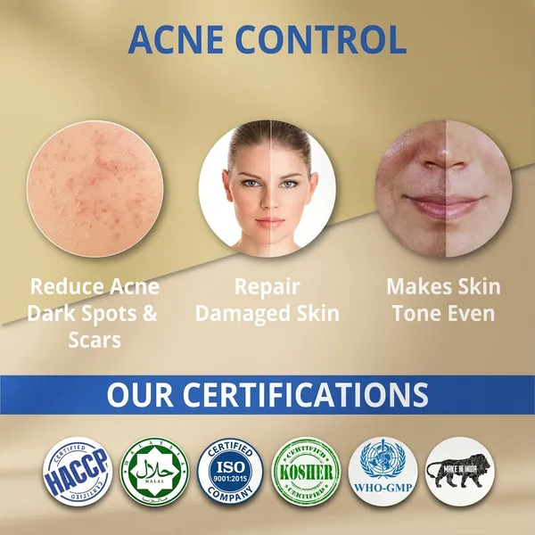 Acne_Control_Face_Treatment_Kit_-_Reduces_Dark_Spots,_Repairs_Damaged_Skin_&_Evens_Skin_Tone_Pack_Of_2