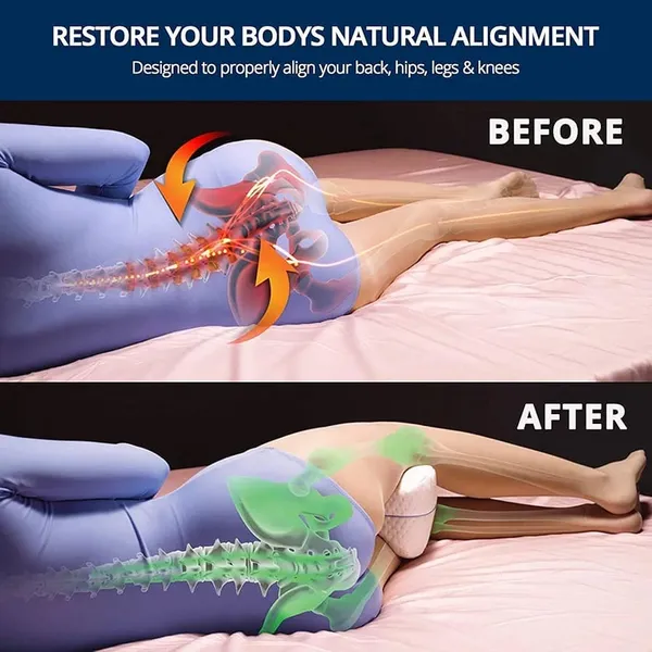 Zudo_Homes_Your_Comfort_PartnerKnee_Pillow,_Knock_Knee_Corrector_for_Sleeping,_Memory_Foam_Leg_Pillow_Wedge_Cushion_for_Side_Sleeper,_Sciatica,_Pregnancy,_Hip_Pain_-_Washable_Cover(10_x_10_x_6)