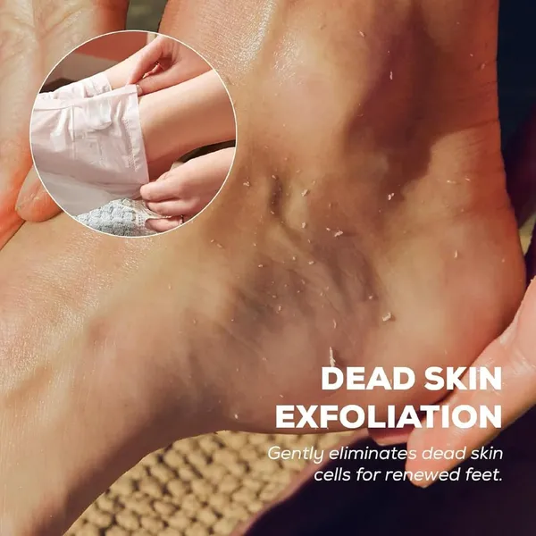 Foot_Peel_Mask_For_Women_And_Men_|_Peeling_And_Exfoliating_Foot_Mask_For_Dry_Cracked_Feet,_Removes_Dead_Skin_And_Calluses,_Hydrates_And_Smooths_Cracked_Heels_(Pack_Of_1)