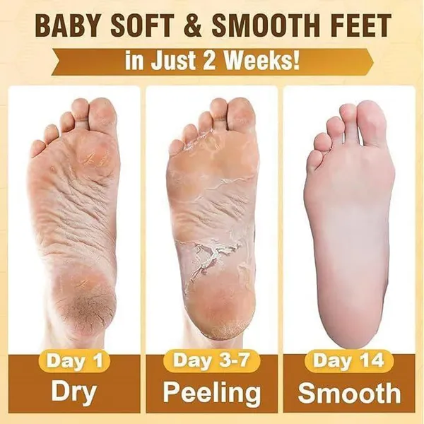 Foot_Peel_Mask_For_Women_And_Men_|_Peeling_And_Exfoliating_Foot_Mask_For_Dry_Cracked_Feet,_Removes_Dead_Skin_And_Calluses,_Hydrates_And_Smooths_Cracked_Heels_(Pack_Of_1)