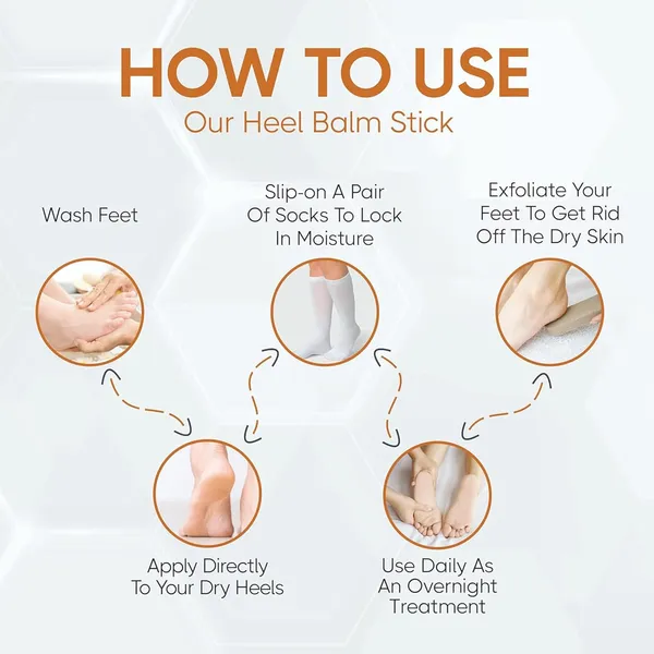 Foot_Repair_Cream_For_Rough,_Dry_And_Cracked_Heel_Feet,_20%_Urea_Cracked_Heel_Repair_Balm_Stick_40G,_Helps_Repair_And_Moisturise_Knees,_Elbows,_Hands_|_Benefits_Of_Shea_Butter_And_Vitamin_E