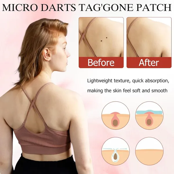 Pro_Micro_Darts_Tag_Gone_Skin_Patches_|_Natural_Nano_Pimple_Plasters_With_Microdart_Technology,_Acne_Spot_Treatment_Patches_For_All_Skin_Types_(4_Sheets)