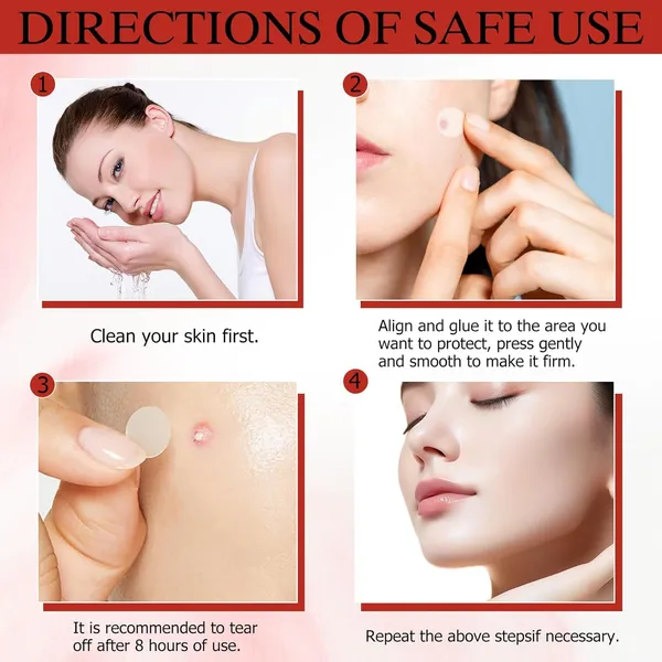 Pro_Micro_Darts_Tag_Gone_Skin_Patches_|_Natural_Nano_Pimple_Plasters_With_Microdart_Technology,_Acne_Spot_Treatment_Patches_For_All_Skin_Types_(4_Sheets)