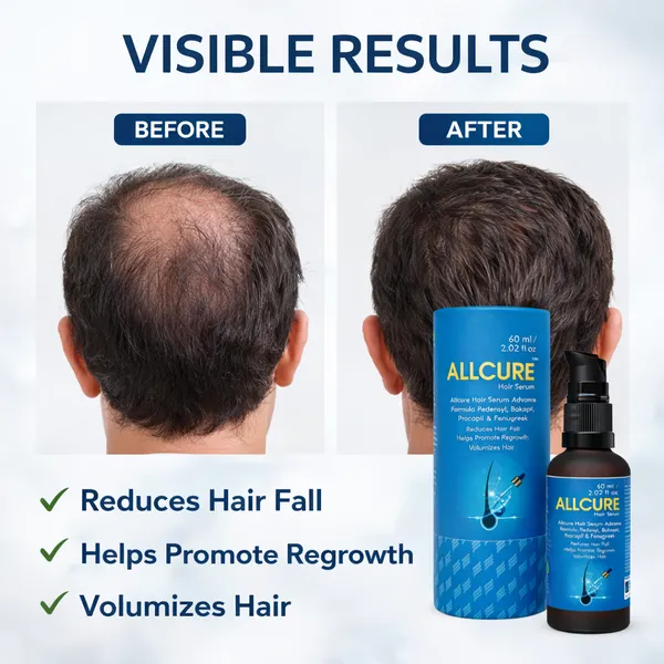 Allcure_Hair_Growth_Serum_-_Advanced_Formula_With_Redensyl,_Baicapil_&_Procapil_(60Ml)