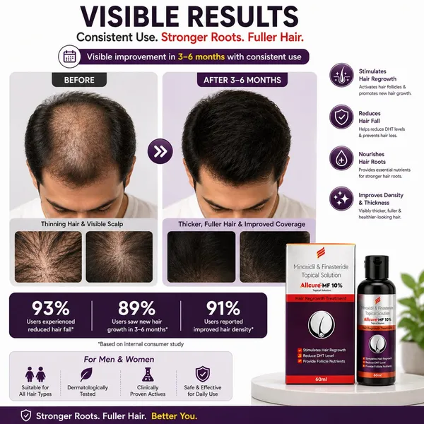 Allcure-MF_10%_Topical_Solution_For_Hair_Regrowth_60_Ml