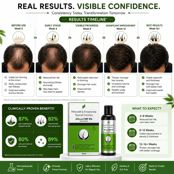 Allcure-MF_5%_Topical_Solution_For_Hair_Regrowth_60_Ml