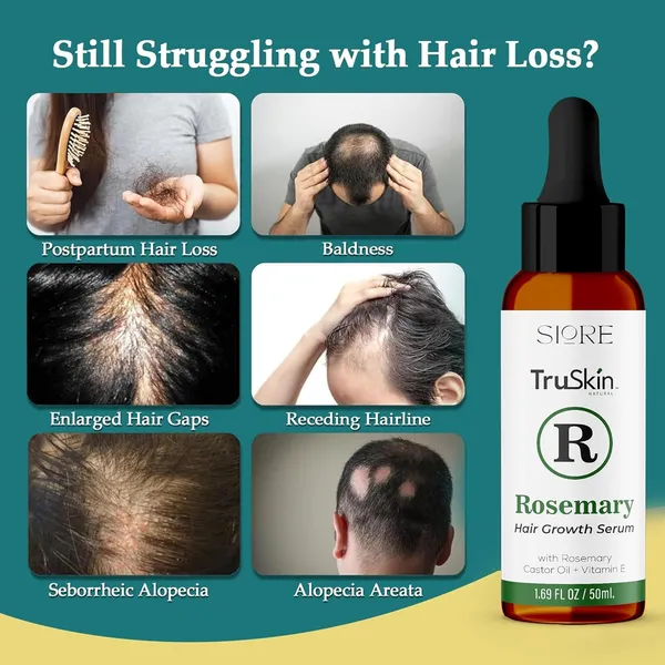 Hair_Growth_Serum_Castor_Oil_Vitamin_E_Strengthens_Roots_Reduces_Split_Ends_Hydrates_Scalp_Hair_Natural_Herbal_Blend_For_All_Hair_Types