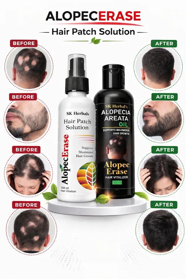 Alopecerase_Hair_Patch_Solution_And_Alopecia_Areata_Oil_Pack_Of_2