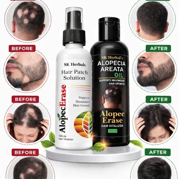 Alopecerase_Hair_Patch_Solution_And_Alopecia_Areata_Oil_Pack_Of_2