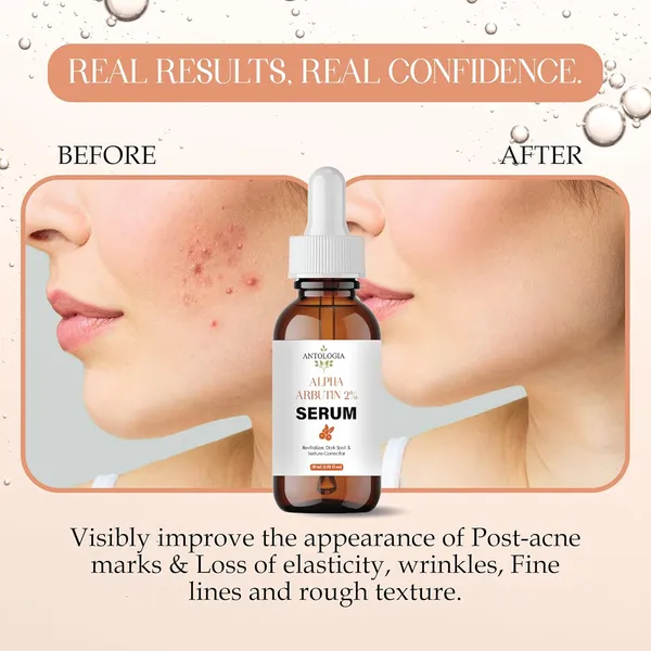 Alpha_Arbutin_Serum_Dark_Spot_And_Texture_Corrector_30_Ml