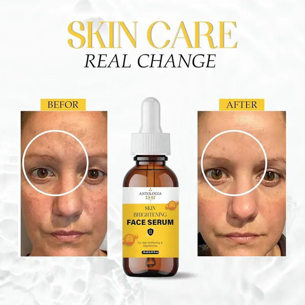 Skin_Brightening_Face_Serum_With_Vitamin_B14_Whitening_Formula_30_Ml