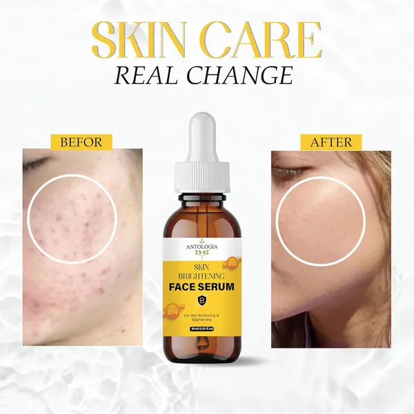 Skin_Brightening_Face_Serum_With_Vitamin_B14_Whitening_Formula_30_Ml