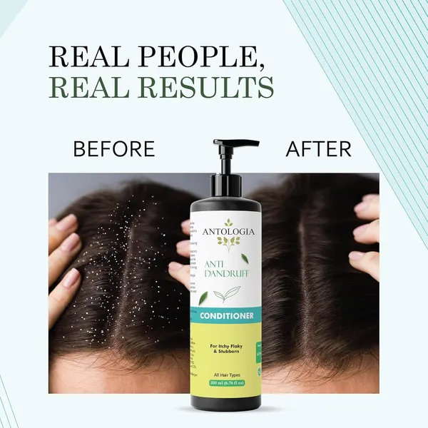 Conditioner_Nourishing_Repairing_Smoothening_All_Hair_Types_Anti_Dandruff_Conditioner_200Ml