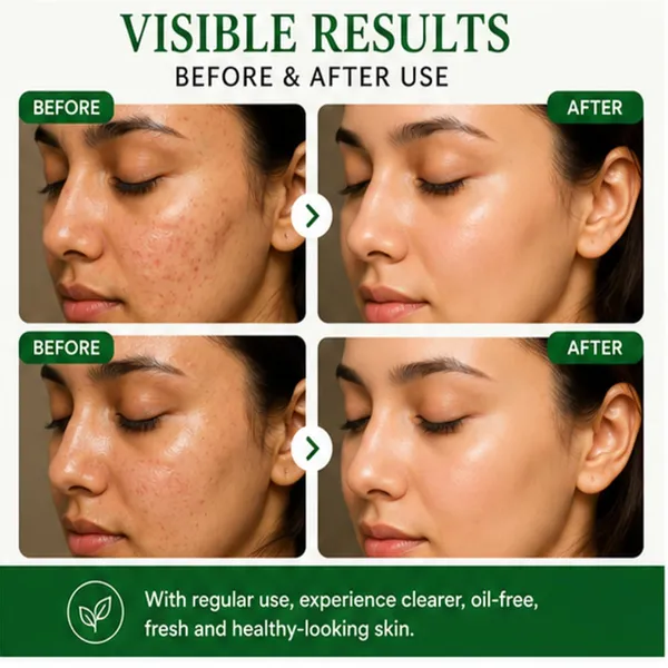 Antologia_Green_Tea_Face_Wash_For_Fresh_Clean_Looking_Skin_Gentle_Daily_Facial_Cleanser_With_Refreshing_Formula_For_Oily_And_Combination_Skin_100ml