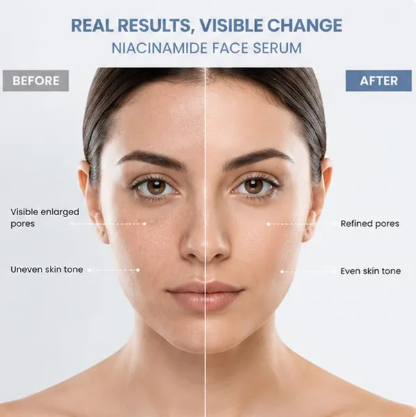 Antologia_Niacinamide_Face_Serum_With_Vitamin_B3_For_Oily_Combination_And_Blemish_Prone_Skin_Helps_Improve_Skin_Tone_Supports_Smoother_Looking_Skin_30_Ml