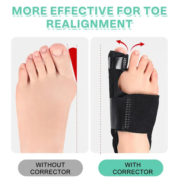 Adjustable_Plastic_Fabric_Bunion_Corrector_Toe_Splint